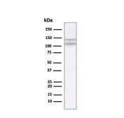 Western blot testing of human heart tissue lysate with CDH2 antibody. Predicted molecular weight ~100 kDa (unmodified), 125-140 kDa (modified).