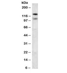 Western blot testing of human brain lysate with CDH2 antibody. Predicted molecular weight ~100 kDa (unmodified), 125-140 kDa (modified).~