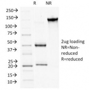 SDS-PAGE Analysis of Purified, BSA-Free Plakophilin 1 Antibody (clone 10B2). Confirmation of Integrity and Purity of the Antibody.