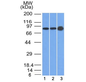 Western blot testing of human 1) U87, 2) HeLa and 3) A431 cell lysate with Plakophilin 1 antibody (clone 10B2). Expected molecular weight: 75-83 kDa.~