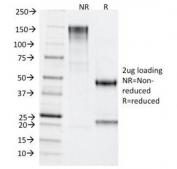 SDS-PAGE Analysis of Purified, BSA-Free TDP2 Antibody (clone TDP2/1258). Confirmation of Integrity and Purity of the Antibody.