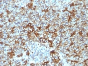 IHC testing of FFPE human pancreas with Spectrin beta III antibody (clone SPTBN2/1583). Required HIER: boil tissue sections in 10mM citrate buffer, pH 6, for 10-20 min followed by cooling at RT for 20 min.