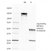 SDS-PAGE Analysis of Purified, BSA-Free Spectrin beta III Antibody (clone SPTBN2/1583). Confirmation of Integrity and Purity of the Antibody.