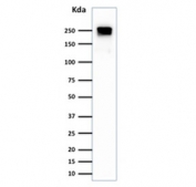 Western blot testing of human HeLa cell lysate with Spectrin beta III antibody. Predicted molecular weight ~246 kDa.