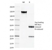SDS-PAGE Analysis of Purified, BSA-Free Spectrin beta III Antibody (clone SPTBN2/1584). Confirmation of Integrity and Purity of the Antibody.