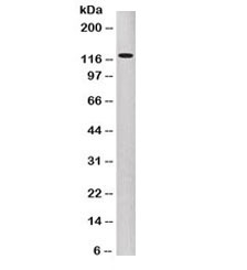 Western blot testing of human A431 cell lysate with P-Cadherin antibody (clone 6A9). Expected molecular weight: ~91 kDa (unmodified), 100~130 kDa (glycosylated).~
