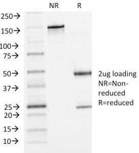 SDS-PAGE Analysis of Purified, BSA-Free P-Cadherin Antibody (clone 6A9). C
