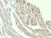 IHC testing of FFPE rat heart with NSE antibody (clone ENO2/1375). Required HIER: boil sections in pH 9 10mM Tris with 1mM EDTA for 10-20 min.