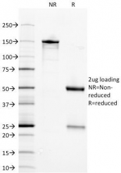 SDS-PAGE Analysis of Purified, BSA-Free NSE Antibody (clone ENO2/1375). Confirmation of Integrity and Purity of the Antibody.