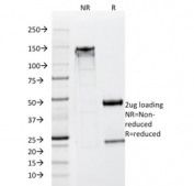 SDS-PAGE analysis of purified, BSA-free NSE antibody (clone SPM347) as confirmation of integrity and purity.