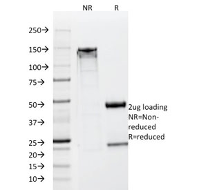SDS-PAGE analysis of purified, BSA-free NSE antibody (clone SPM347) as confirmation