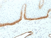 IHC testing of FFPE human cervical tissue with Poloplanin antibody (clone PDPN/1433). Required HIER: boil tissue sections in 10mM citrate buffer, pH 6, for 10-20 min followed by cooling at RT for 20 min.