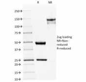 SDS-PAGE Analysis of Purified, BSA-Free Spectrin beta III Antibody (clone SPTBN2/1582). Confirmation of Integrity and Purity of the Antibody.