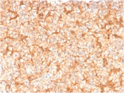 IHC testing of FFPE human pancreas with Spectrin beta III antibody (clone SPTBN2/1582). Required HIER: boil tissue sections in EDTA buffer, pH9, for 10-20 min followed by cooling at RT for 20 min.