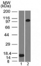 Western blot testing of 1) recombinant partial protein and 2) human ThP1 lysate with Thrombomodulin antibody (clone THBD/1591). Expected molecular weight ~60/100 kDa (unmodified/glycosylated).