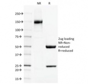 SDS-PAGE Analysis of Purified, BSA-Free Thrombomodulin Antibody (clone THBD/1591). Confirmation of Integrity and Purity of the Antibody.