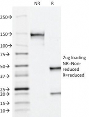 SDS-PAGE Analysis of Purified, BSA-Free PSAP Antibody (ACPP/1338). Confirmation of Integrity and Purity of the Antibody.