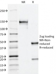 SDS-PAGE Analysis of Purified, BSA-Fre