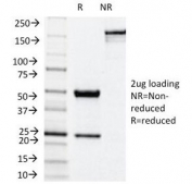SDS-PAGE Analysis of Purified, BSA-Free NOX4 Antibody (clone NOX4/1245). Confirmation of Integrity and Purity of the Antibody.