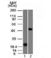 Western blot testing of 1) human partial recombinant protein and 2) human Raji cell lysate with PAX-8 antibody (clone PAX8/1491). Predicted molecular weight of isoforms 1-5: 31, 35, 42, 43 and 48 kDa, respectively. PAX-8 can also be observed at ~62 kDa.
