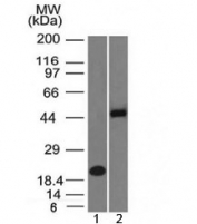 Western blot testing of 1) human partial recombinant protein and 2) human Raji cell lysate with PAX8 antibody (clone PAX8/1492). Predicted molecular weight of isoforms 1-5: 31, 35, 42, 43 and 48 kDa, respectively. PAX8 can also be observed at ~62 kDa.