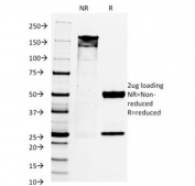 SDS-PAGE Analysis of Purified, BSA-Free PAX8 Antibody (clone PAX8/1492). Confirmation of Integrity and Purity of the Antibody.