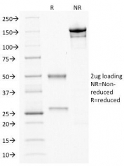SDS-PAGE Analysis of Purified, BSA-Free CDX2 Antibody (clone CDX2/1690). Confirmation of Integrity and Purity of the Antibody.