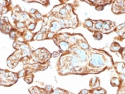 IHC testing of FFPE human placenta with Thymidine Phosphorylase antibody (clone P-GF.44C). Required HIER: requires boil tissue sections in 10mM citrate buffer, pH 6, for 10-20 min followed by cooling at RT for 20 min.