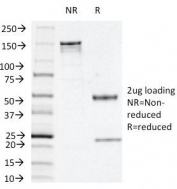 SDS-PAGE Analysis of Purified, BSA-Free Thymidine Phosphorylase Antibody (clone P-GF.44C). Confirmation of Integrity and Purity of the Antibody.