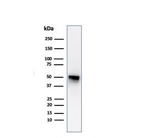Western blot testing of human spleen lysate with Thymidine Phosphorylase antibody (clone P-GF.44C). Predicted molecular weight ~55 kDa.~