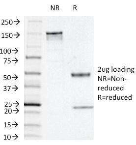 SDS-PAGE Analysis of Purified, BSA-Free Thymidine Phosphorylase Antibody (clone P-GF.44C). Confirmat