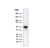 Western blot testing of human spleen lysate with Thymidine Phosphorylase antibody (clone P-GF.44C). Predicted molecular weight ~55 kDa.