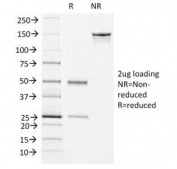 SDS-PAGE analysis of purified, BSA-free vWF antibody (clone VWF/1465) as confirmation of integrity and purity.