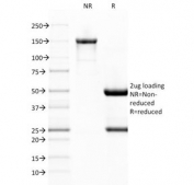 SDS-PAGE analysis of purified, BSA-free vWF antibody (clone VWF/1767) as confirmation of integrity and purity.