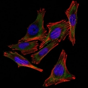 Immunofluorescence testing of A2058 cells and Alexa Fluor 488 labeled S100B antibody (clone 4C4.9).