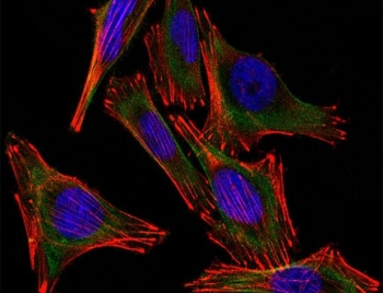 (Left) Confocal Immunofluorescent analysis of A2058 cells using AF488-labeled S100 antibody (green). F-actin filaments were labeled with DyLight 554 Phalloidin (red). DAPI was used to stain the cell nuclei (blue). (Right) Negative control.~