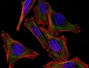 (Left) Confocal Immunofluorescent analysis of A2058 cells using AF488-labeled S100 antibody (green). F-actin filaments were labeled with DyLight 554 Phalloidin (red). DAPI was used to stain the cell nuclei (blue). (Right) Negative control.