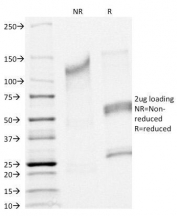 SDS-PAGE Analysis of Purified, BSA-Free CFTR Antibody (clone CFTR/1341). Confirmation of Integrity and Purity of the Antibody.