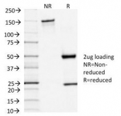 SDS-PAGE Analysis of Purified, BSA-Free TSHR Antibody (clone TSHRA/1402). Confirmation of Integrity and Purity of the Antibody.