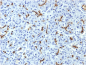 CFTR Antibody Pancreas IHC. Immunohistochemistry analysis of Cystic fibrosis transmembrane conductance regulator / CFTR expression in FFPE human pancreas tissue using mouse monoclonal antibody clone CFTR/1643. HRP-DAB brown staining is observed in ductal epithelial structures with apical membranous and luminal accentuation, while surrounding acinar and stromal cells show minimal signal; nuclei are counterstained blue. The staining pattern is consistent with polarized epithelial localization of CFTR in pancreatic ducts. Antigen retrieval was performed by boiling sections in 10 mM Tris buffer with 1 mM EDTA, pH 9, for 10-20 min followed by cooling at room temperature.