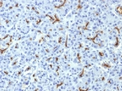 IHC testing of FFPE human pancreas with CFTR antibody (clone CFTR/1643). HIER: boil tissue sections in 10mM Tris with 1mM EDTA, pH9 for 10-20 min followed by cooling at RT for 20 min.