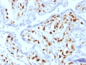 IHC testing of FFPE human placenta with Factor XIIIa antibody (clone SPM180). Required HIER: boil tissue sections in pH 9 10mM Tris with 1mM EDTA for 10-20 min.