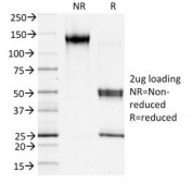 SDS-PAGE Analysis of Purified, BSA-Free FSP1 Antibody (clone S100A4/1481). Confirmation of Integrity and Purity of the Antibody.