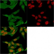 IF/ICC testing of fixed and permeabilized human HeLa cells with FSP1 antibody (clone S100A4/1481, green) and Reddot nuclear stain (red).