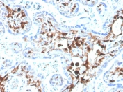 IHC testing of FFPE human placenta with biotinylated FSP1 antibody (clone S100A4/1481). HIER: boil tissue sections in pH 9 10mM Tris with 1mM EDTA for 20 min and allow to cool before testing.