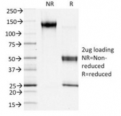 SDS-PAGE analysis of purified, BSA-free FSP1 antibody as confirmation of integrity and purity.