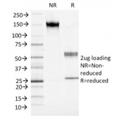 SDS-PAGE analysis of purified, BSA-free S100A4 antibody (clone S100A4/1482) as confirmation of integrity and purity.