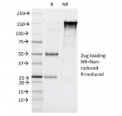 SDS-PAGE Analysis of Purified, BSA-Free Elastase 3B Antibody (clone CELA3B/1257). Confirmation of Integrity and Purity of the Antibody.