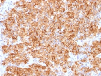 IHC analysis of FFPE human parathyroid gland stained with recombinant Chromogranin A antibody (clone CHGA/1773R). Required HIER: steam sections in pH6 citrate buffer for 10-20 min.~