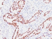 IHC testing of human colon with Retinoblastoma antibody (clone SPM353). Required HIER: boil tissue sections in pH 9 10mM Tris with 1mM EDTA for 10-20 min followed by cooling at RT for 20 min.